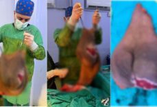Hastanın karnından çıkarıldı: Tam 40 kilogram