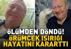 Örümcek ısırığı hayatını kararttı! 61 yaşındaki adam ölümden döndü